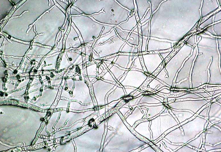 Microscopic view of branching fungal hyphae strands in gray and white tones